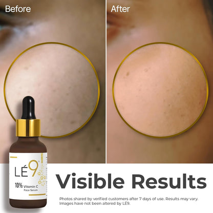 LÉ9 10% Vitamin C Face Serum.